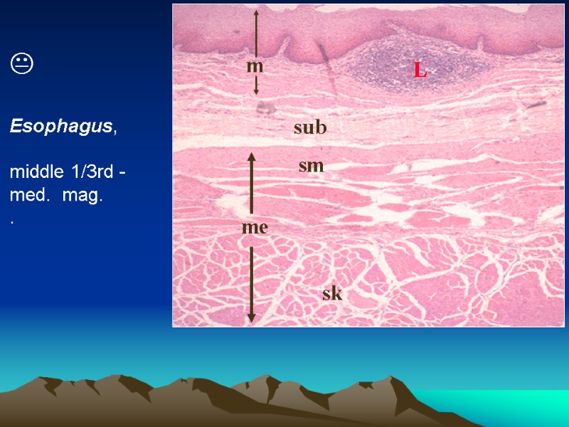 L sub me sm sk m    Esophagus,  middle 1/3rd -